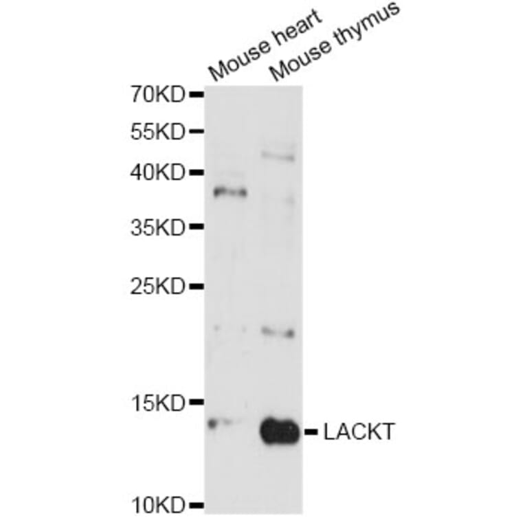 Western Blot - Anti-LACRT Antibody (A14632) - Antibodies.com