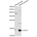 Western Blot - Anti-LACRT Antibody (A14632) - Antibodies.com