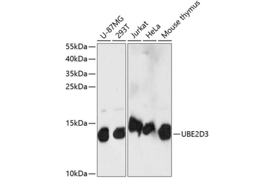 Western Blot - Anti-UBE2D3 Antibody (A88279) - Antibodies.com