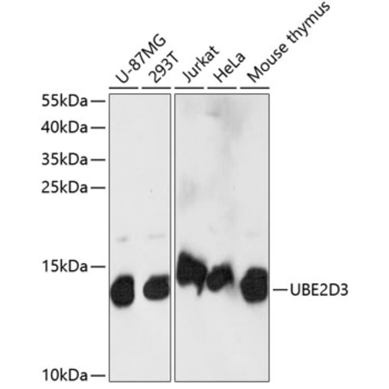 Western Blot - Anti-UBE2D3 Antibody (A88279) - Antibodies.com