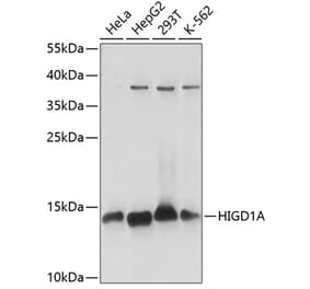 Western Blot - Anti-HIGD1A Antibody (A88280) - Antibodies.com