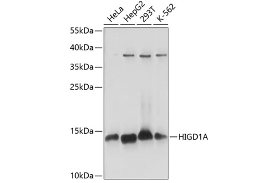 Western Blot - Anti-HIGD1A Antibody (A88280) - Antibodies.com