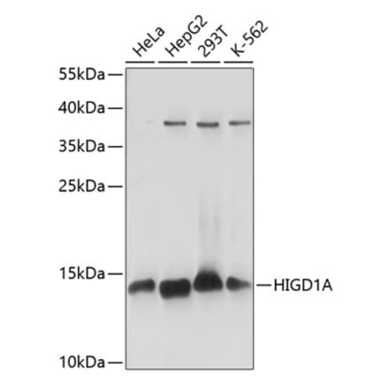 Western Blot - Anti-HIGD1A Antibody (A88280) - Antibodies.com