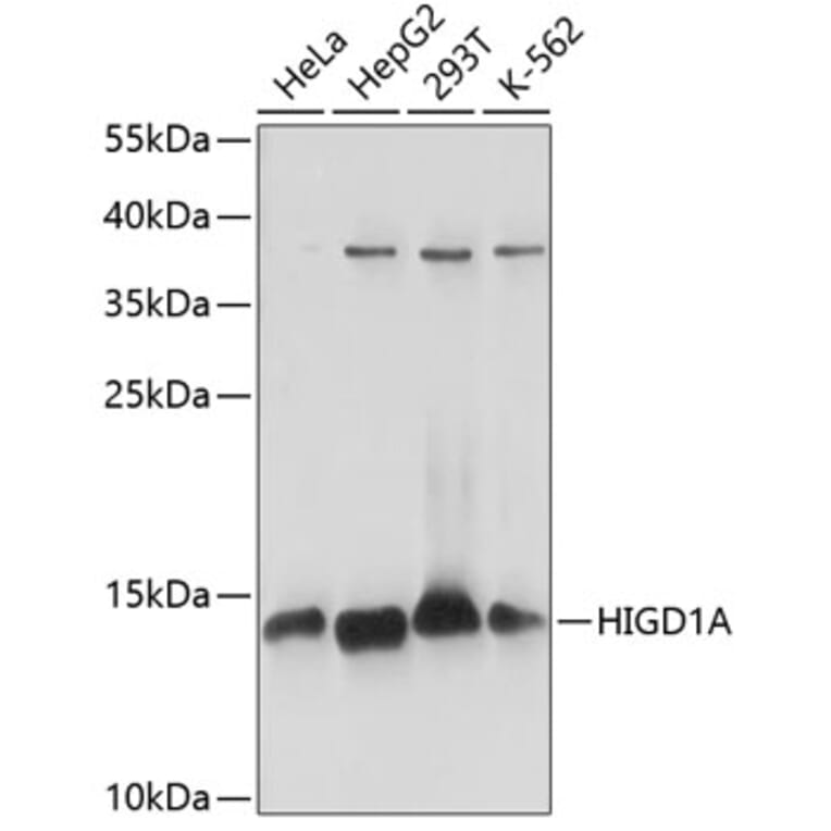 Western Blot - Anti-HIGD1A Antibody (A88280) - Antibodies.com