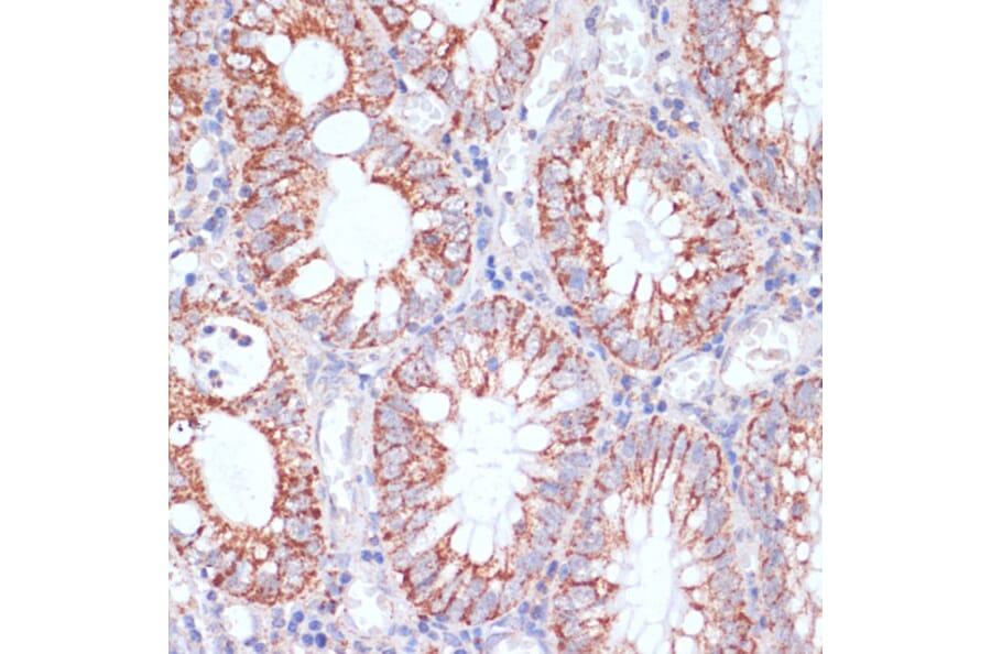 Immunohistochemistry - Anti-HIGD1A Antibody (A88280) - Antibodies.com