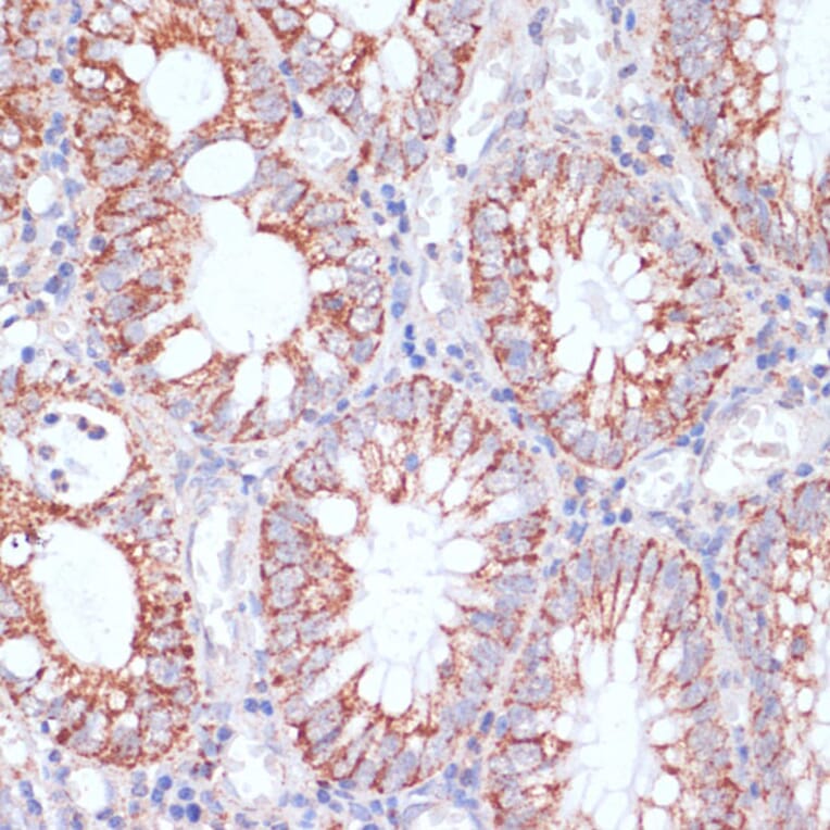 Immunohistochemistry - Anti-HIGD1A Antibody (A88280) - Antibodies.com