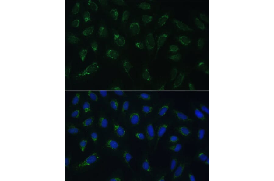 Immunofluorescence - Anti-HIGD1A Antibody (A88280) - Antibodies.com