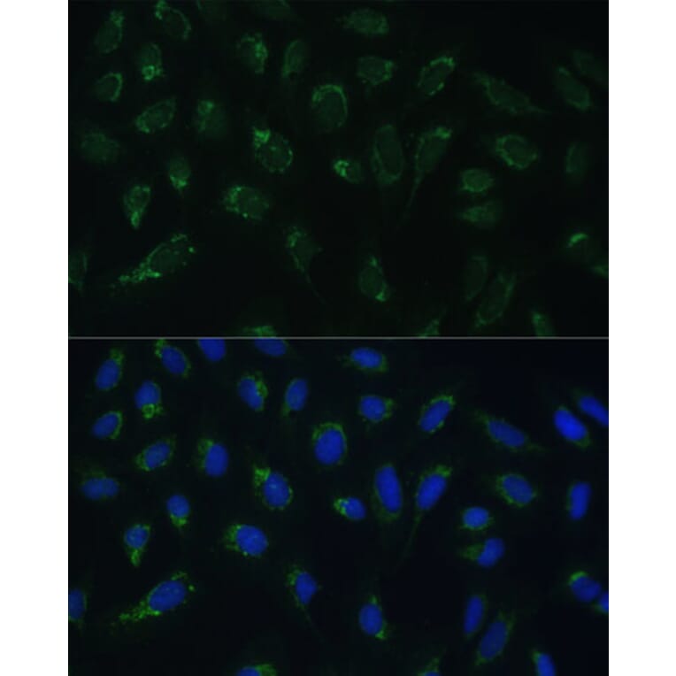 Immunofluorescence - Anti-HIGD1A Antibody (A88280) - Antibodies.com
