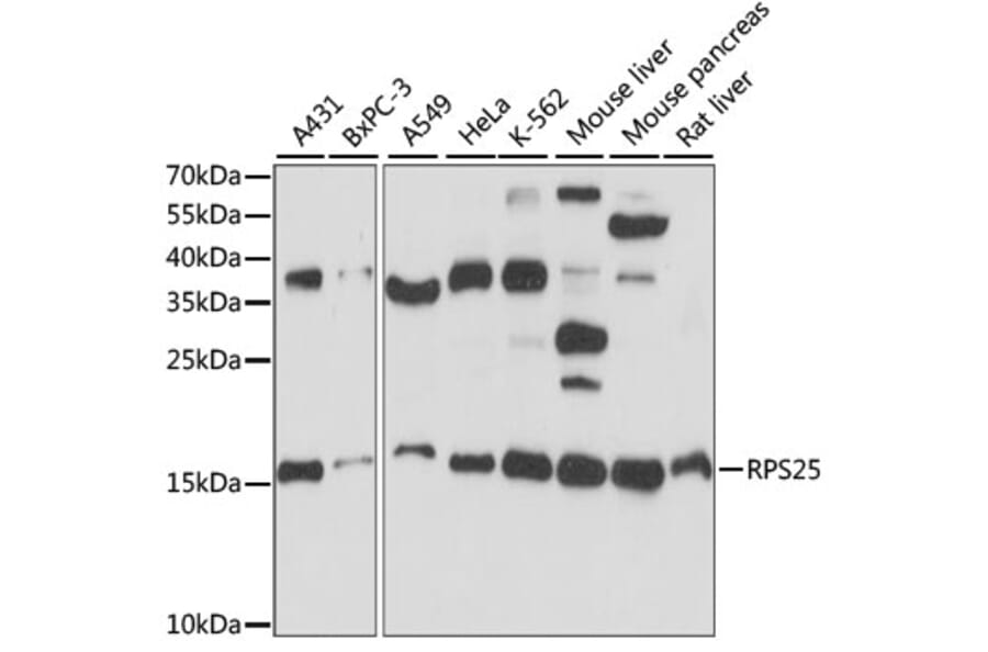 Western Blot - Anti-RPS25 Antibody (A88282) - Antibodies.com