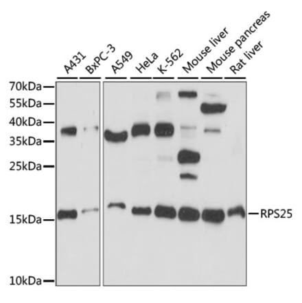 Western Blot - Anti-RPS25 Antibody (A88282) - Antibodies.com