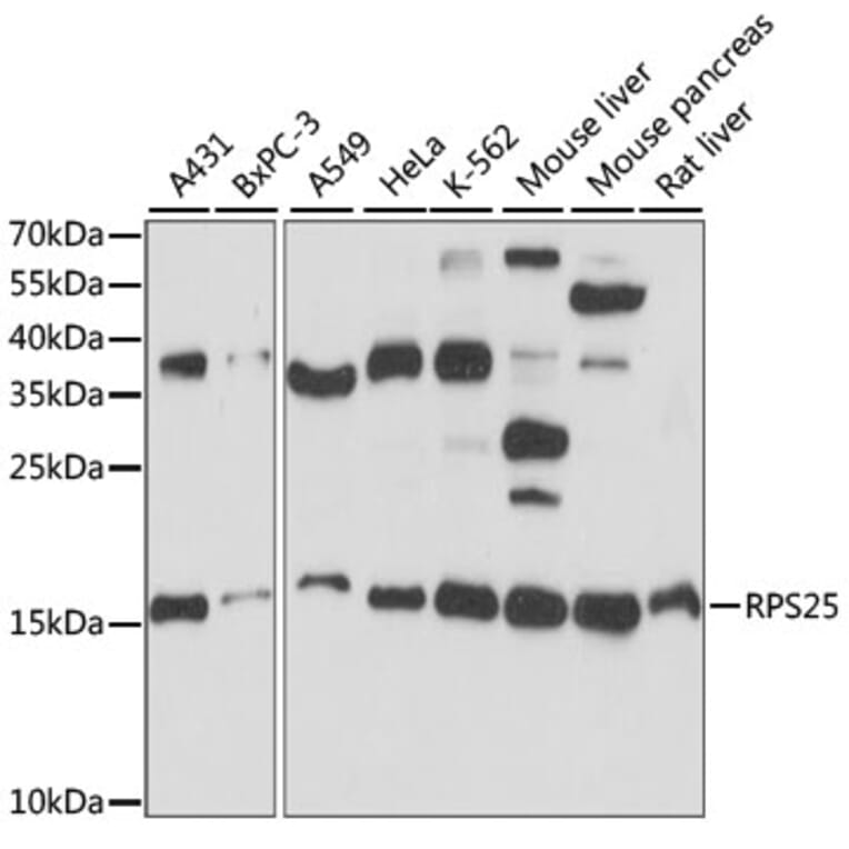 Western Blot - Anti-RPS25 Antibody (A88282) - Antibodies.com