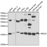 Western Blot - Anti-RPS25 Antibody (A88282) - Antibodies.com