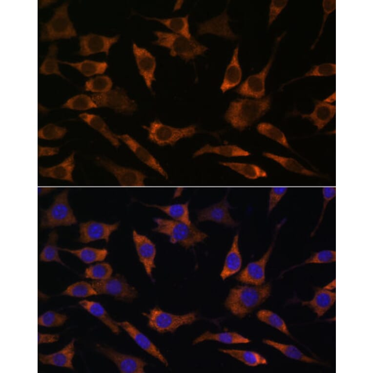 Immunofluorescence - Anti-RPS25 Antibody (A88282) - Antibodies.com