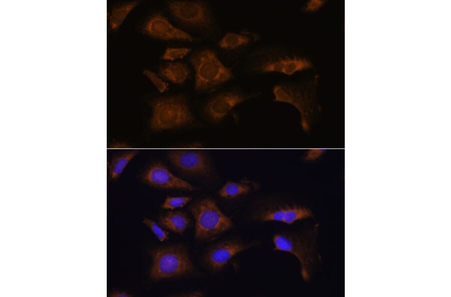 Immunofluorescence - Anti-RPS25 Antibody (A88282) - Antibodies.com