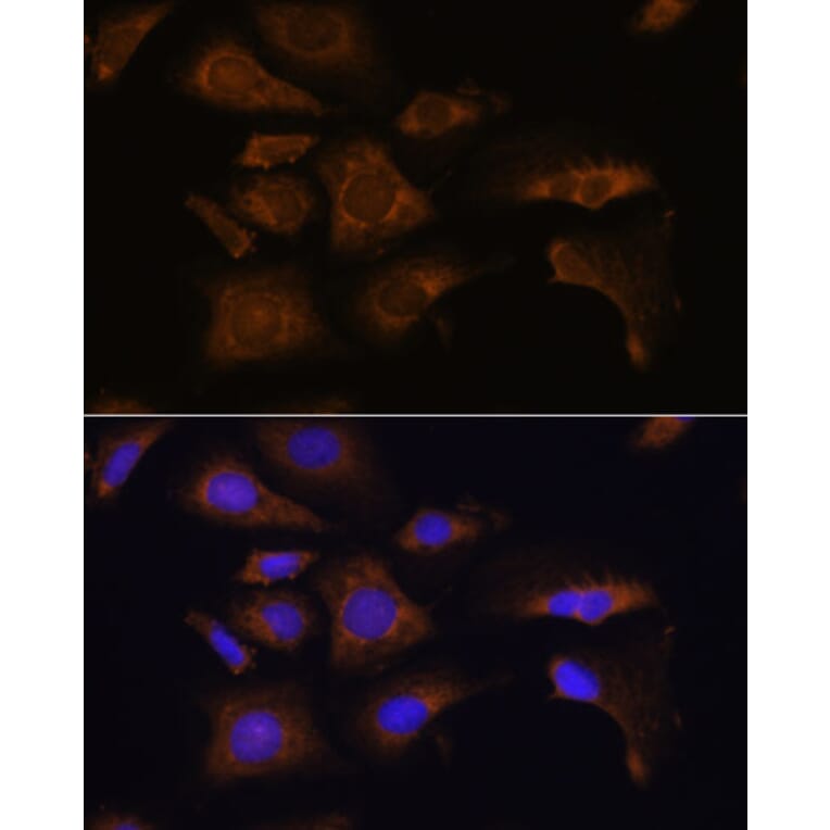 Immunofluorescence - Anti-RPS25 Antibody (A88282) - Antibodies.com