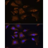Immunofluorescence - Anti-RPS25 Antibody (A88282) - Antibodies.com