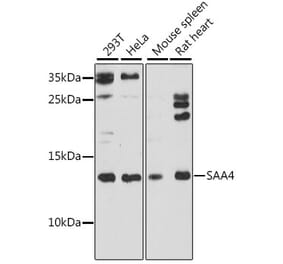 Western Blot - Anti-SAA4 Antibody (A88283) - Antibodies.com