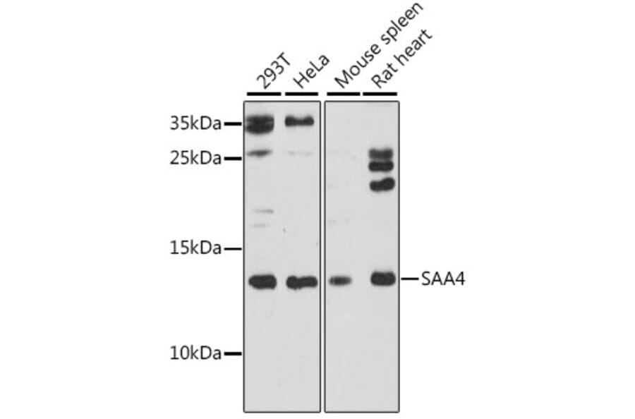 Western Blot - Anti-SAA4 Antibody (A88283) - Antibodies.com