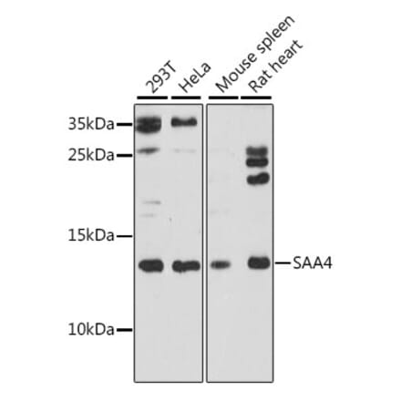 Western Blot - Anti-SAA4 Antibody (A88283) - Antibodies.com