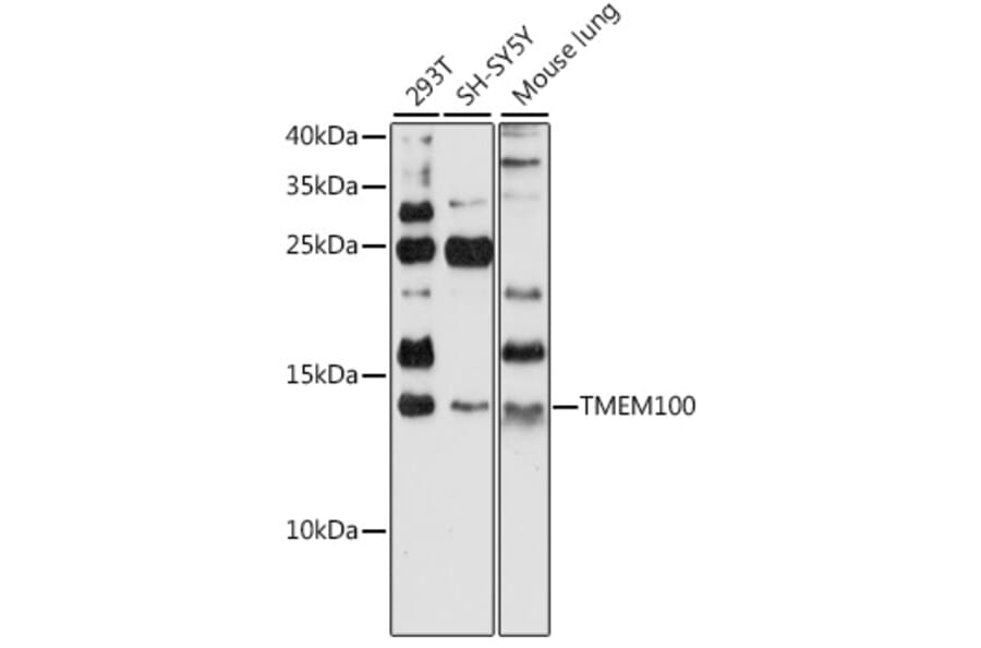 Western Blot - Anti-TMEM100 Antibody (A88284) - Antibodies.com