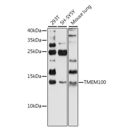 Western Blot - Anti-TMEM100 Antibody (A88284) - Antibodies.com