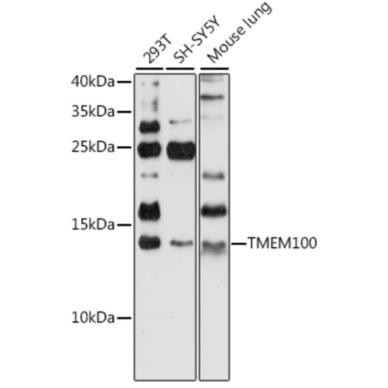 Western Blot - Anti-TMEM100 Antibody (A88284) - Antibodies.com