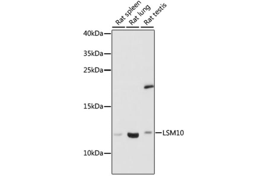 Western Blot - Anti-LSM10 Antibody (A88285) - Antibodies.com