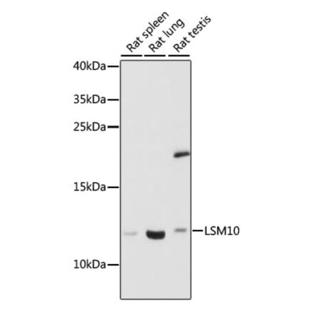 Western Blot - Anti-LSM10 Antibody (A88285) - Antibodies.com