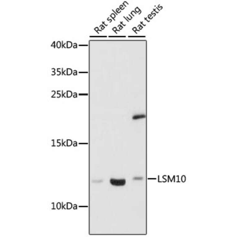 Western Blot - Anti-LSM10 Antibody (A88285) - Antibodies.com