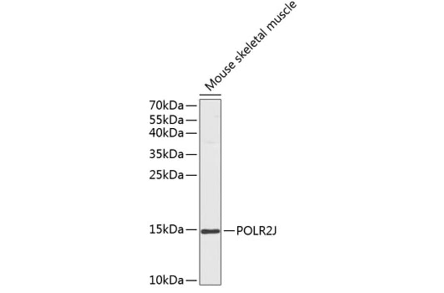 Western Blot - Anti-RNA polymeraseII RPB11 Antibody (A88287) - Antibodies.com
