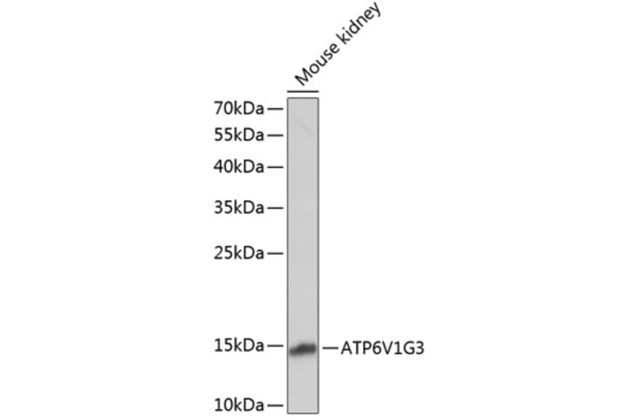 Western Blot - Anti-ATP6V1G3 Antibody (A88288) - Antibodies.com