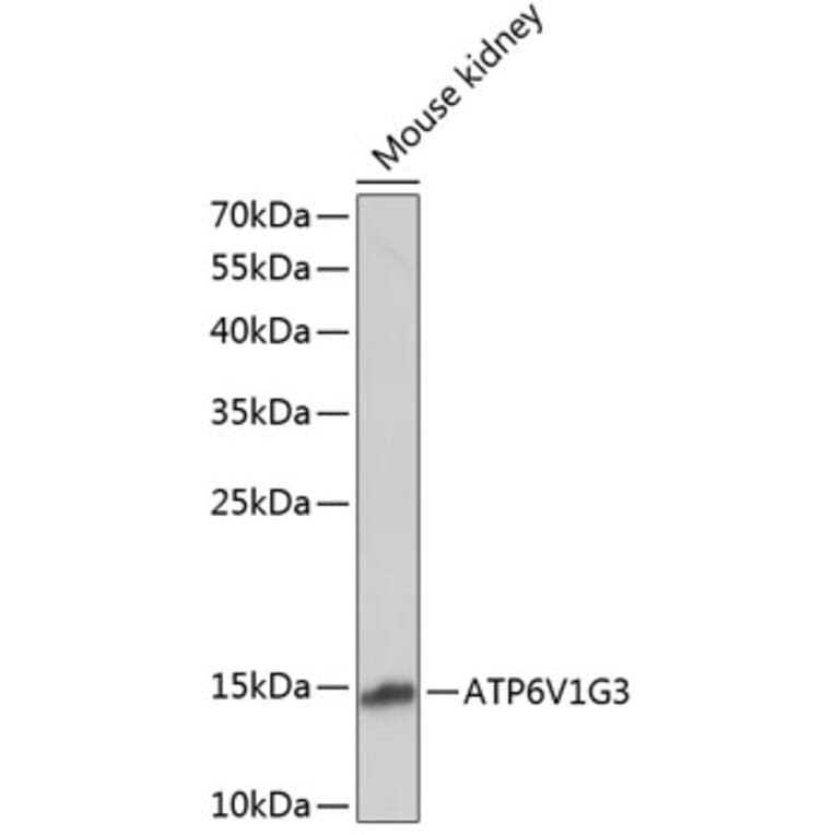 Western Blot - Anti-ATP6V1G3 Antibody (A88288) - Antibodies.com