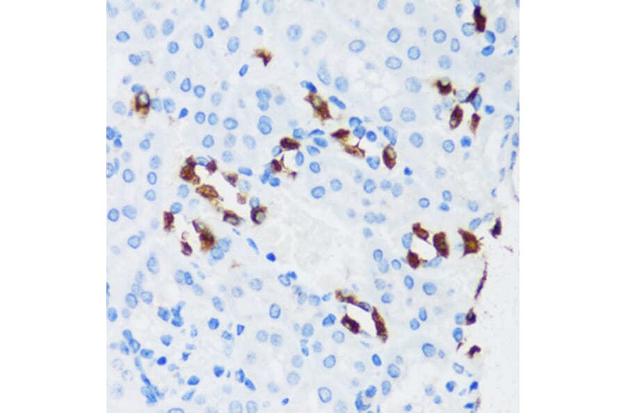 Immunohistochemistry - Anti-ATP6V1G3 Antibody (A88288) - Antibodies.com