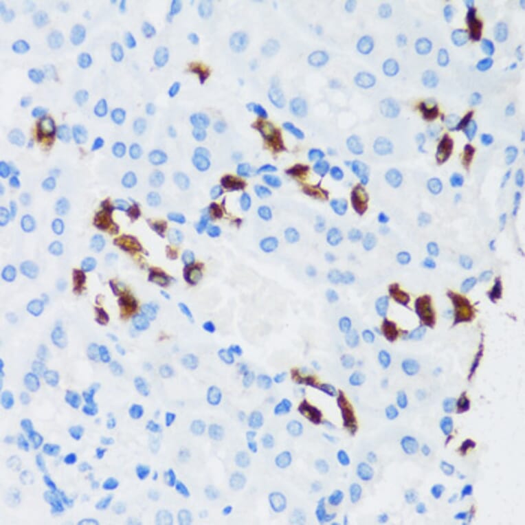Immunohistochemistry - Anti-ATP6V1G3 Antibody (A88288) - Antibodies.com