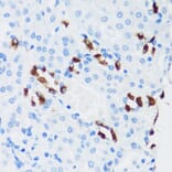 Immunohistochemistry - Anti-ATP6V1G3 Antibody (A88288) - Antibodies.com