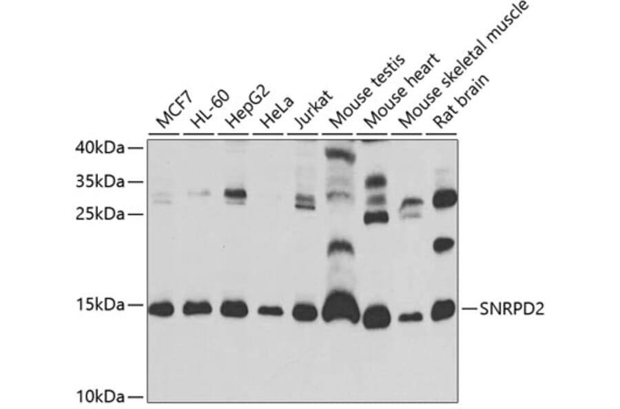 Western Blot - Anti-SNRPD2 Antibody (A13356) - Antibodies.com