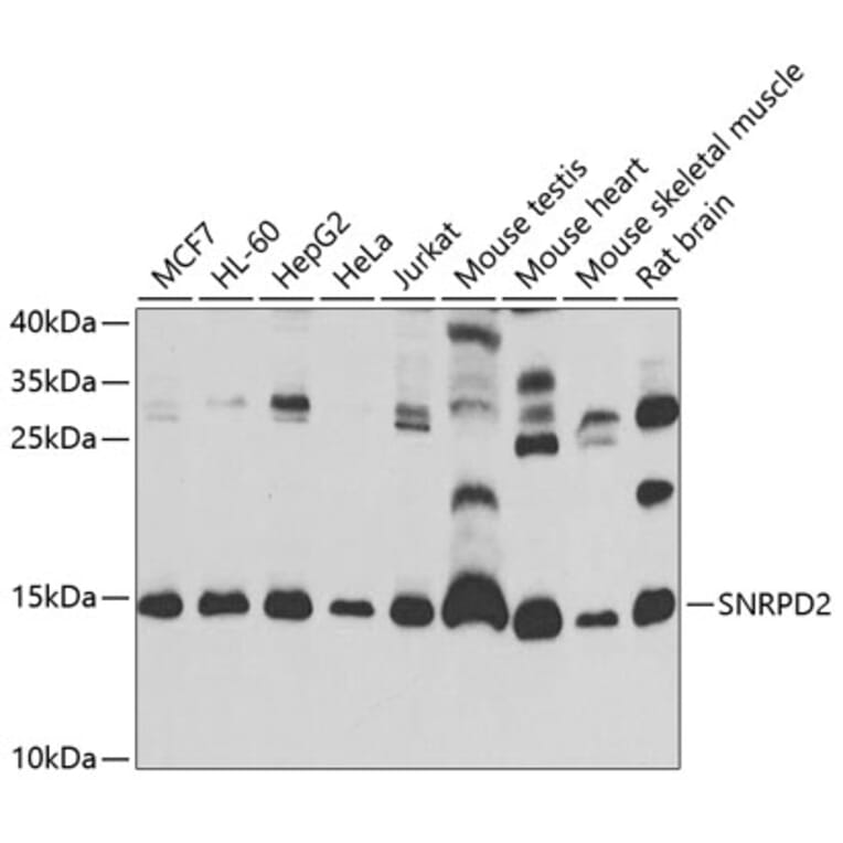 Western Blot - Anti-SNRPD2 Antibody (A13356) - Antibodies.com