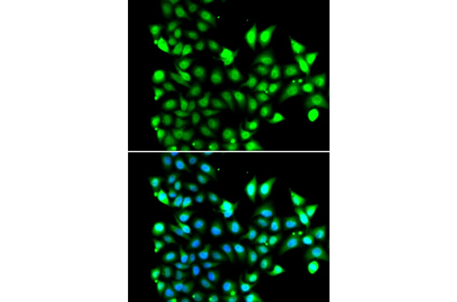Immunofluorescence - Anti-SNRPD2 Antibody (A13356) - Antibodies.com