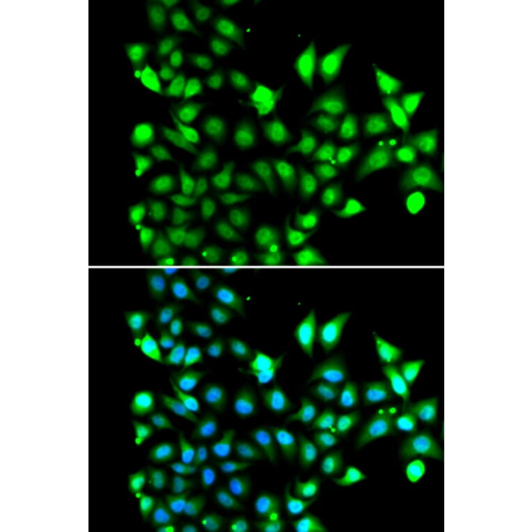 Immunofluorescence - Anti-SNRPD2 Antibody (A13356) - Antibodies.com