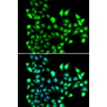 Immunofluorescence - Anti-SNRPD2 Antibody (A13356) - Antibodies.com