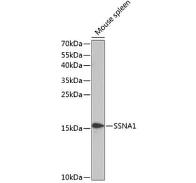 Western Blot - Anti-SSNA1 Antibody (A88290) - Antibodies.com