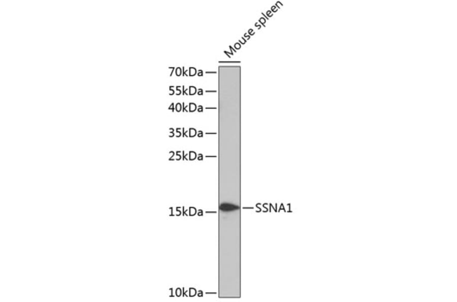 Western Blot - Anti-SSNA1 Antibody (A88290) - Antibodies.com