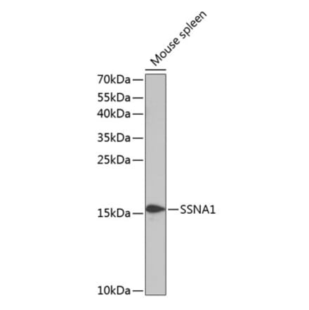 Western Blot - Anti-SSNA1 Antibody (A88290) - Antibodies.com