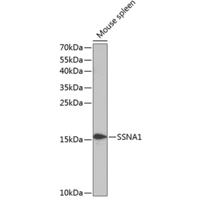 Western Blot - Anti-SSNA1 Antibody (A88290) - Antibodies.com