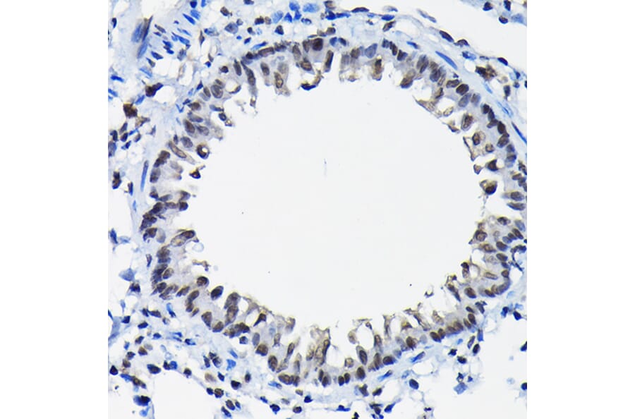 Immunohistochemistry - Anti-SSNA1 Antibody (A88290) - Antibodies.com