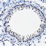 Immunohistochemistry - Anti-SSNA1 Antibody (A88290) - Antibodies.com