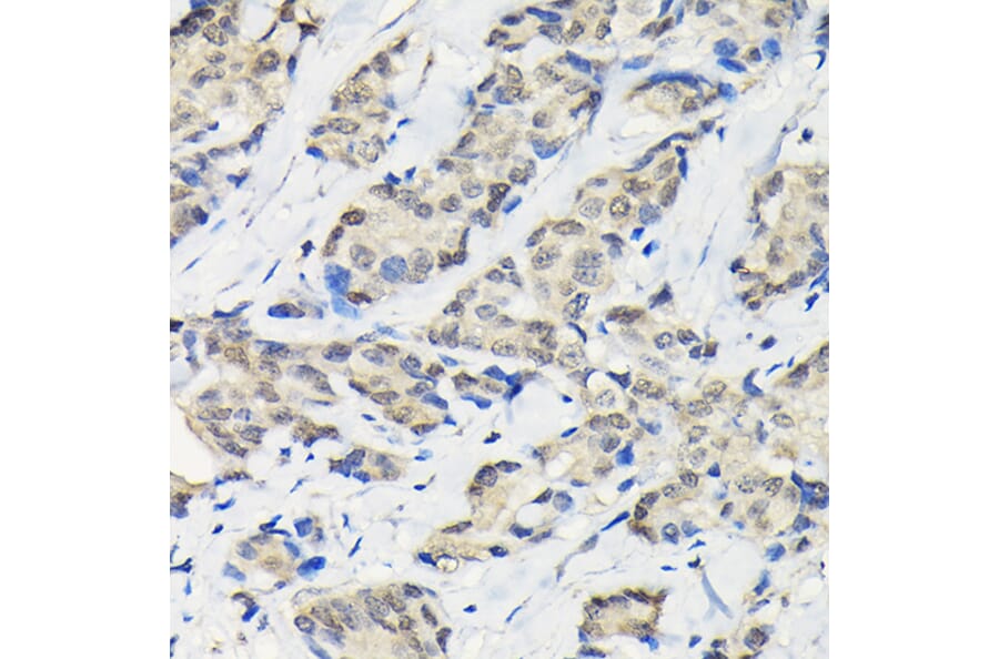 Immunohistochemistry - Anti-SSNA1 Antibody (A88290) - Antibodies.com