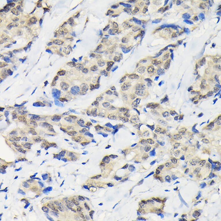 Immunohistochemistry - Anti-SSNA1 Antibody (A88290) - Antibodies.com