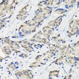 Immunohistochemistry - Anti-SSNA1 Antibody (A88290) - Antibodies.com