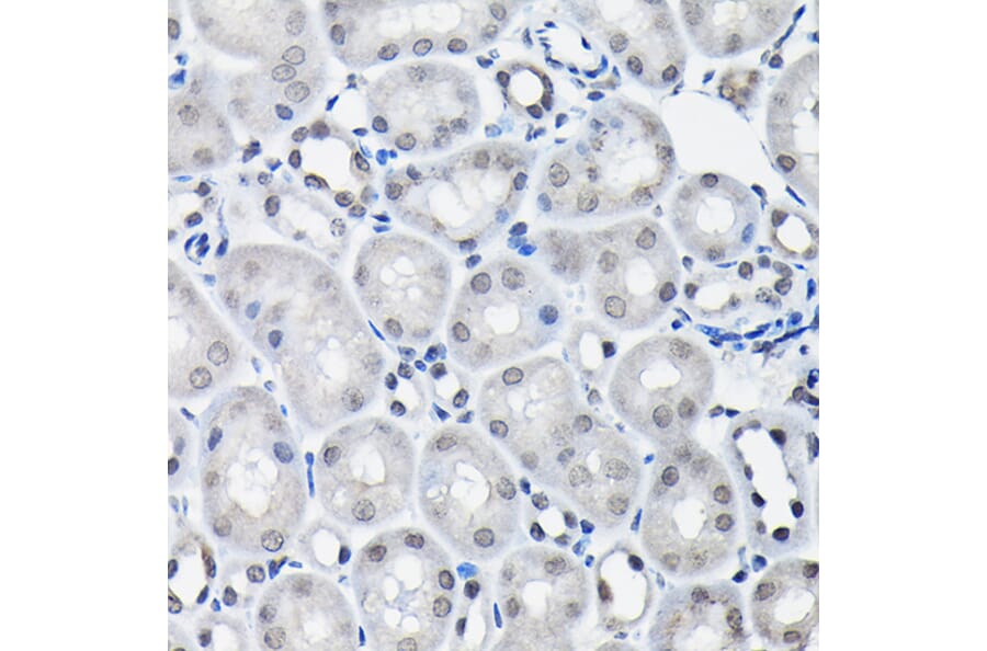 Immunohistochemistry - Anti-SSNA1 Antibody (A88290) - Antibodies.com
